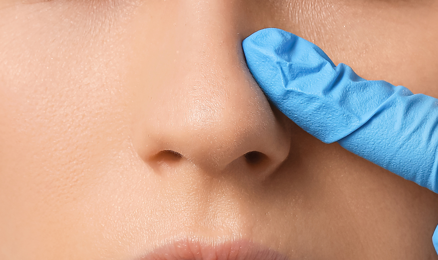 Botox Nose