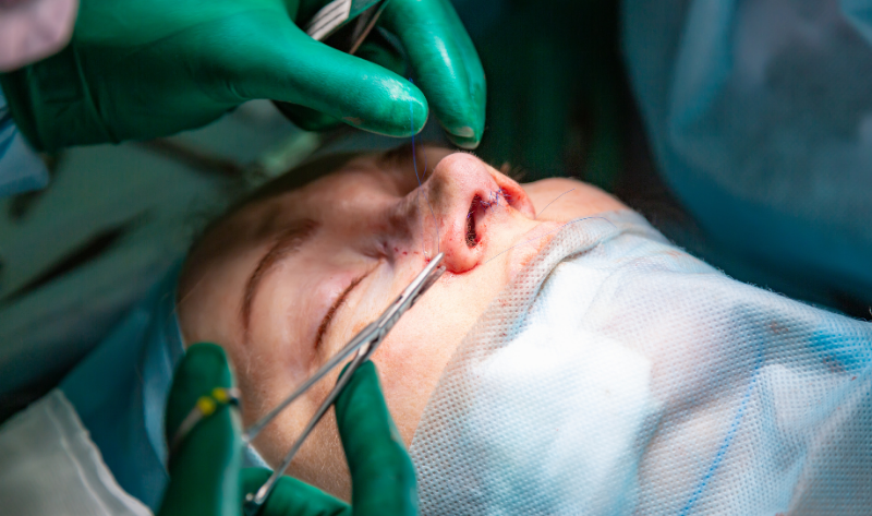 Nose Cancer Surgery in Surat