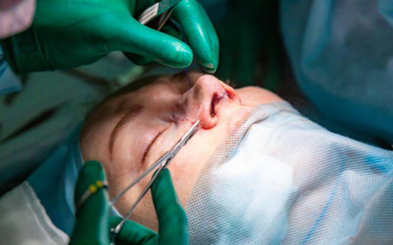Nose Cancer Surgery in Surat
