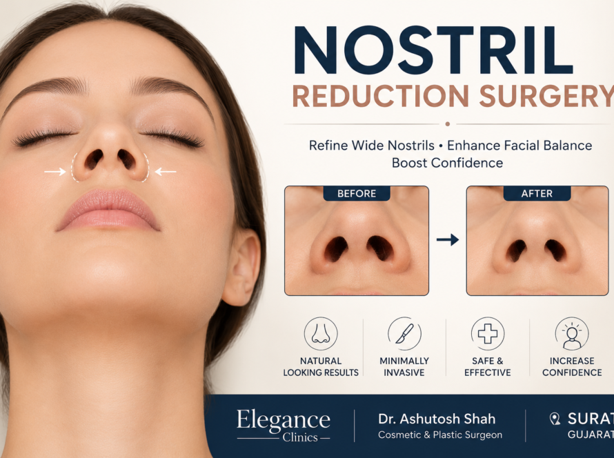 nostril reduction