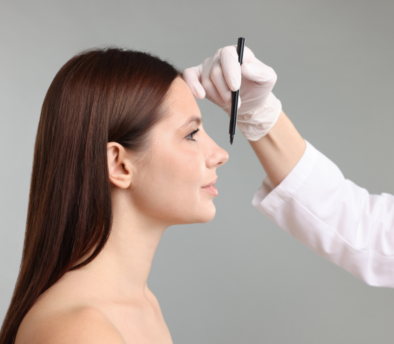 Revision Rhinoplasty