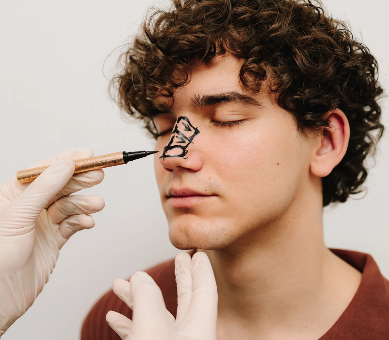 Septoplasty Surgery