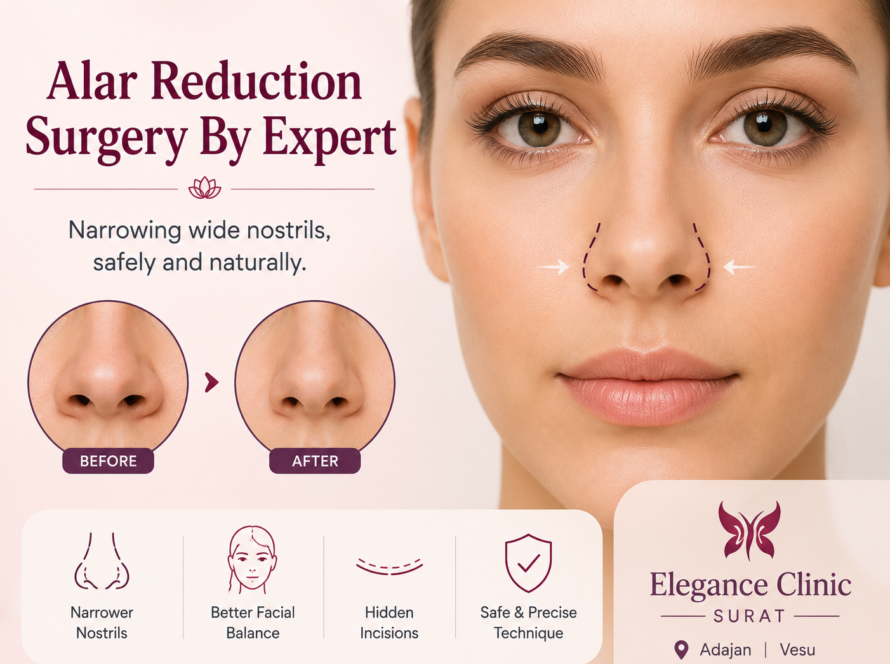 Alar Reduction Surgery By Expert